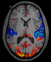 fmri_scan